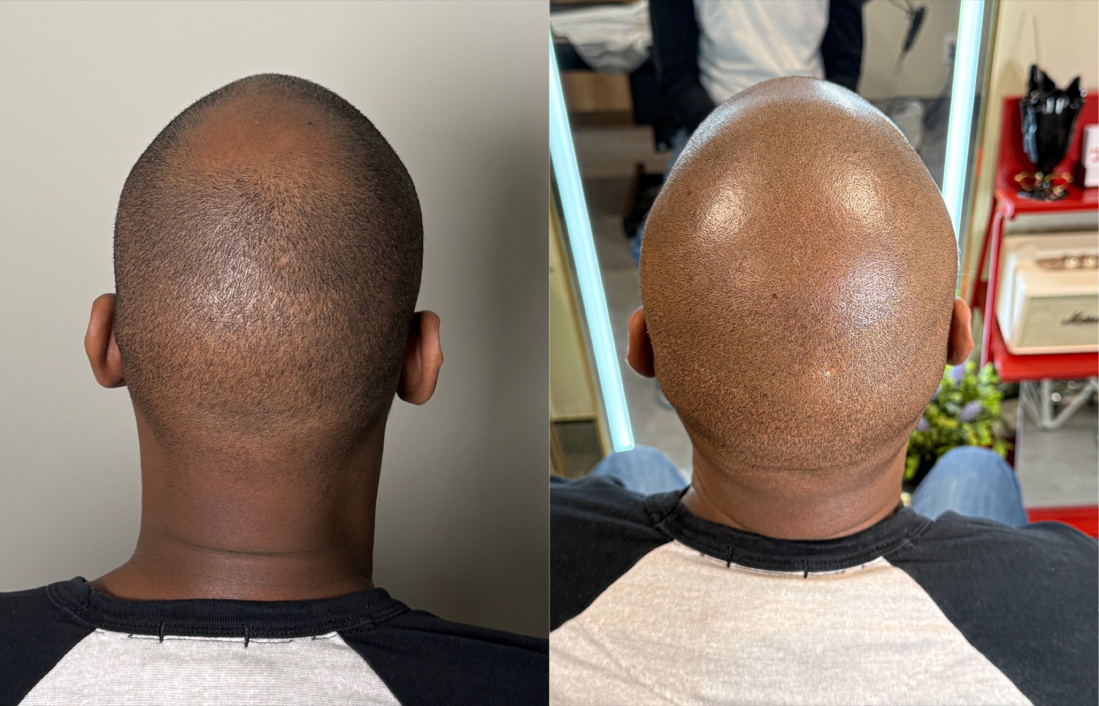 Shaved look SMP portfolio 21